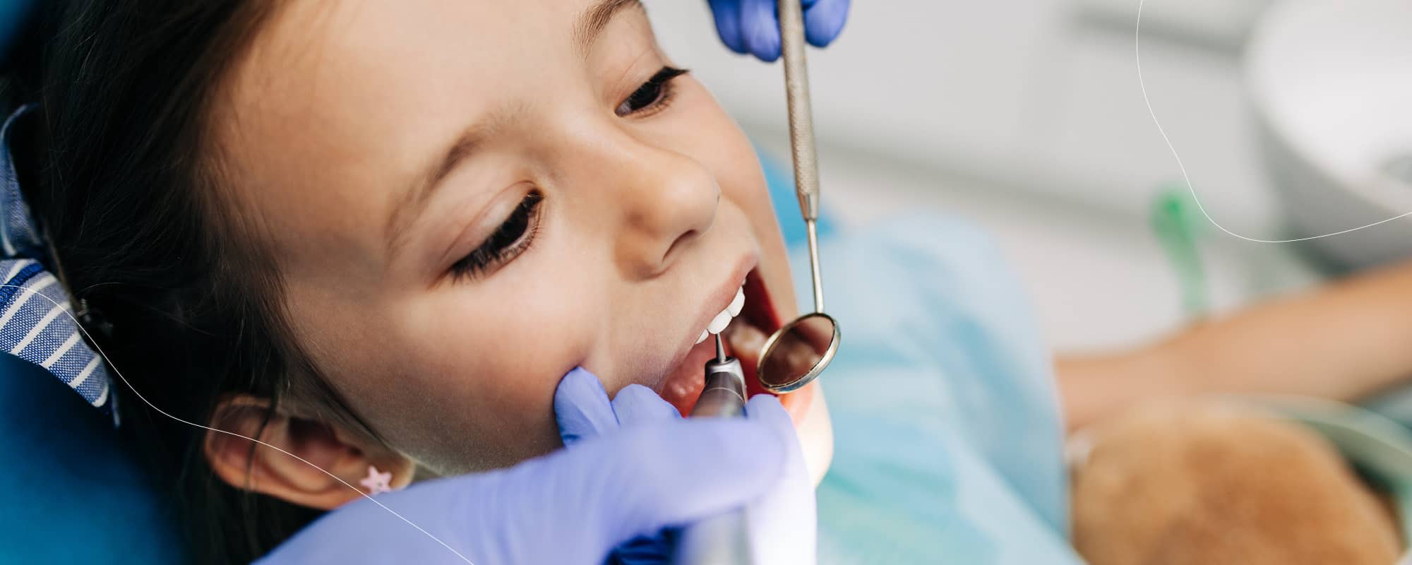 Malocclusioni dentali nei bambini: quali sono e come si curano i principali problemi ortodontici in età pediatrica?