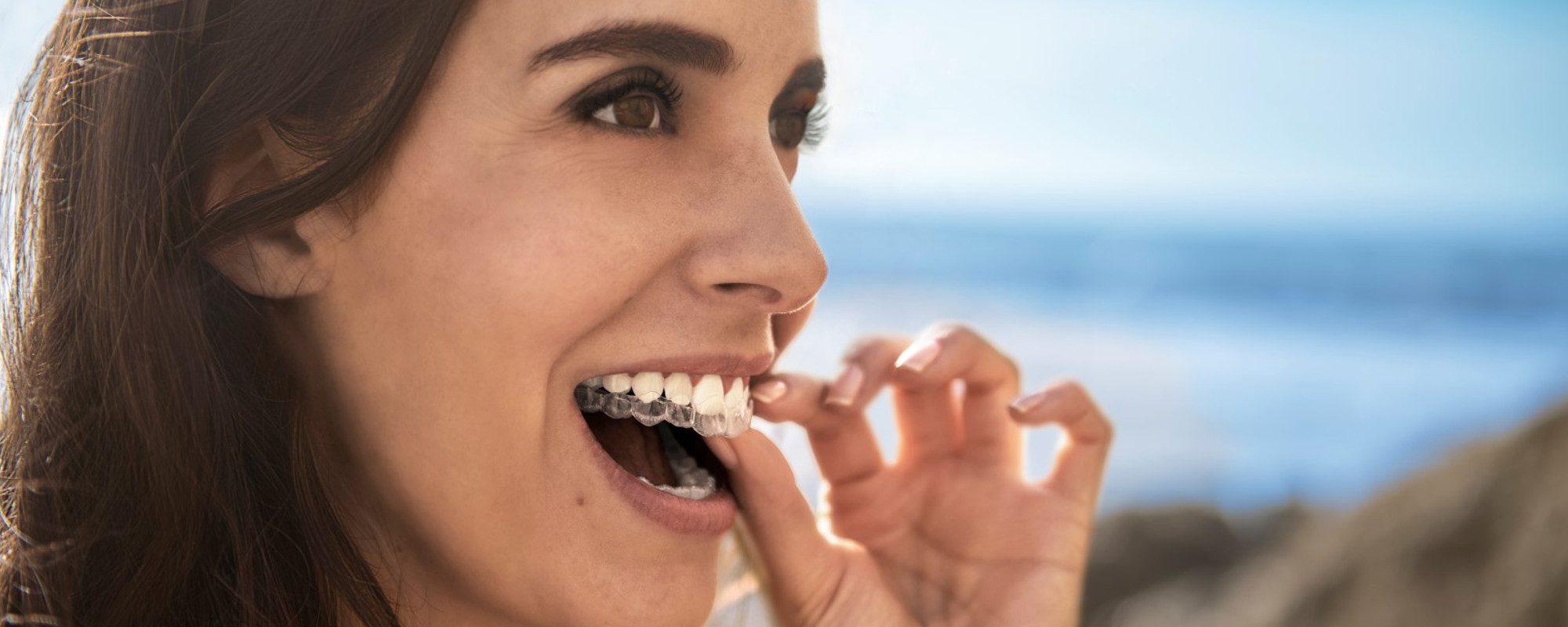 Come saranno i miei denti dopo l’ortodonzia invisibile? Scoprilo in 30 minuti con BlueSmile il 13 dicembre!